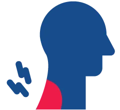 cervical radiculopathy