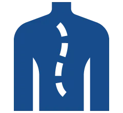 cervical spondylosis