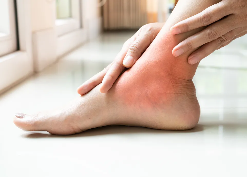 complex pain syndrome