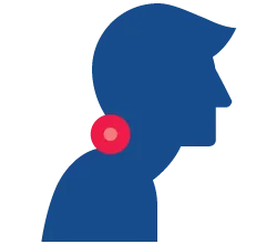 muscle strain and tension