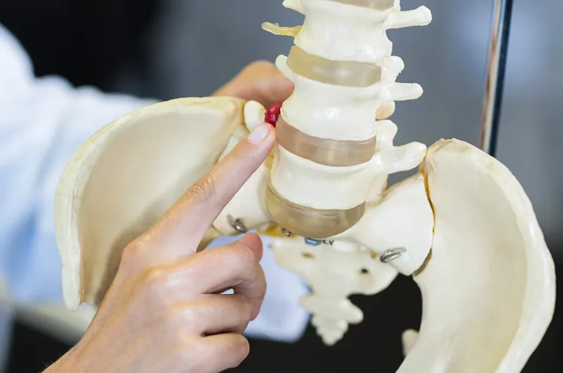degenerative disc disease
