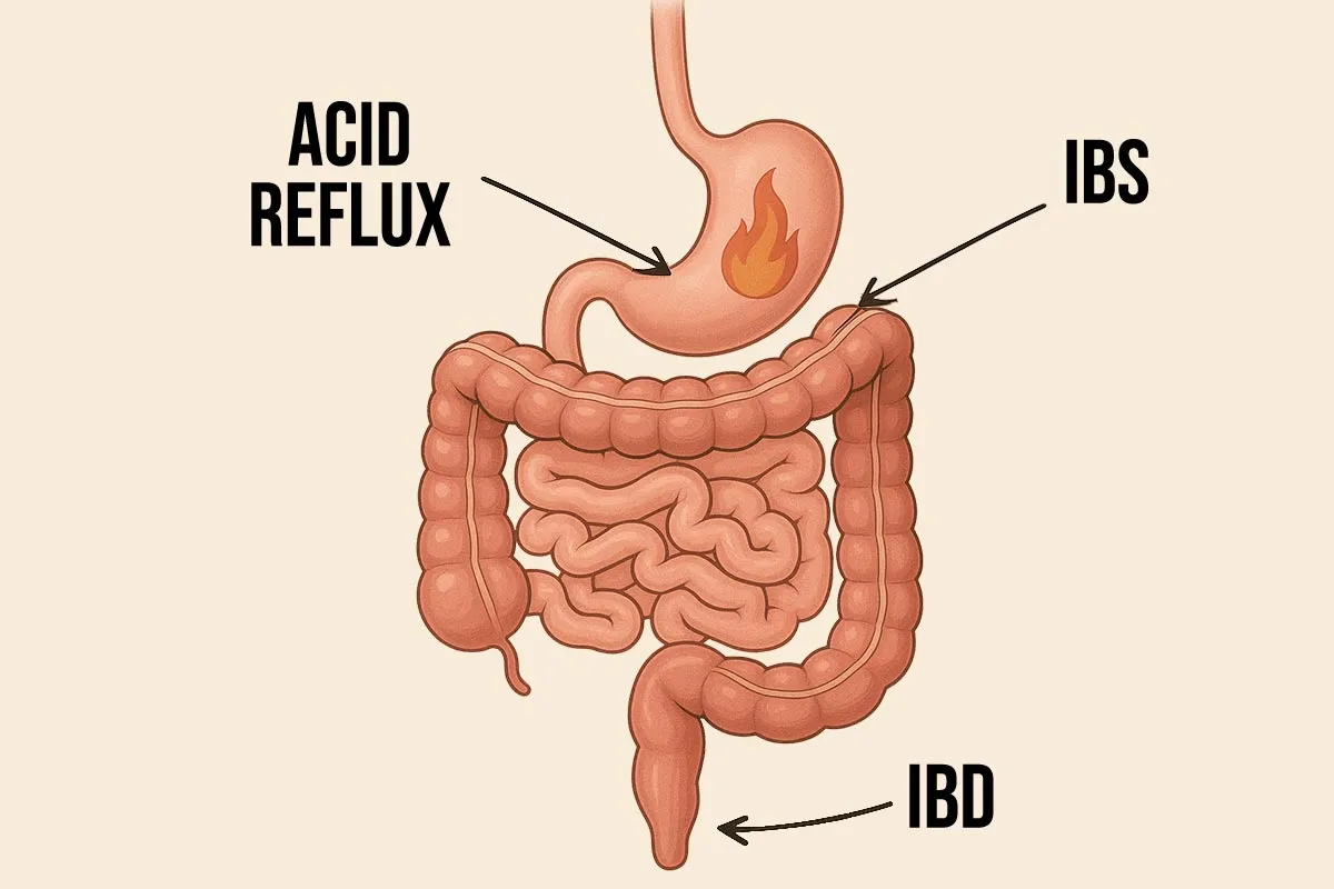 can digestive disorders cause stomach pain that comes and goes