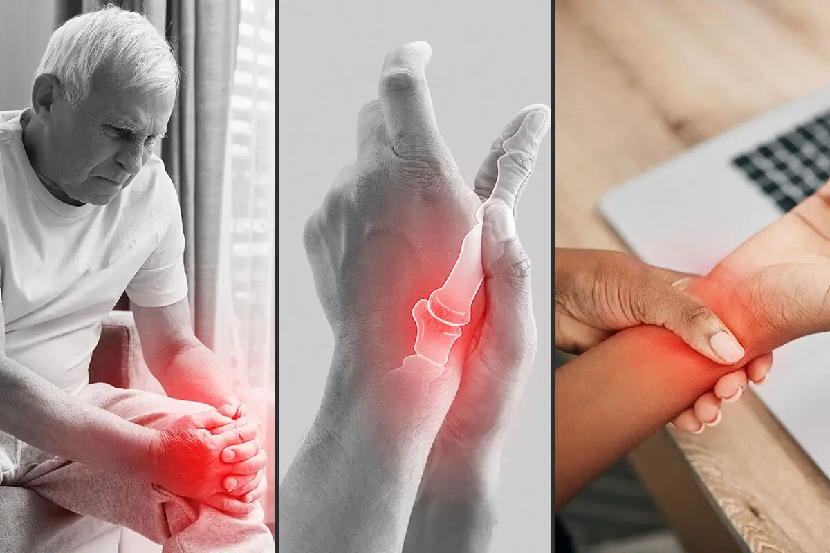 types-of-arthritis-the-complete-breakdown
